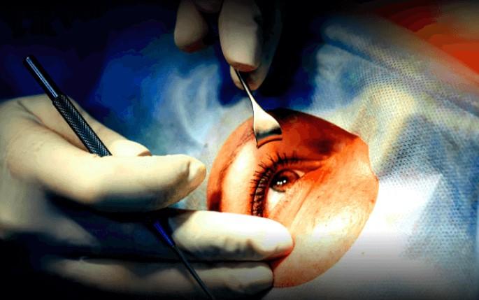 Cataract Surgical Devices Market Outlook Analysis Research   Rhabits D63472a00458f64bb42ab2d302d2784e 